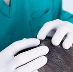doctor-dermatologist-with-gloves-examines-childs-head.jpg