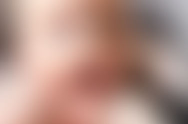 تأخر ظهور الأسنان الدائمة