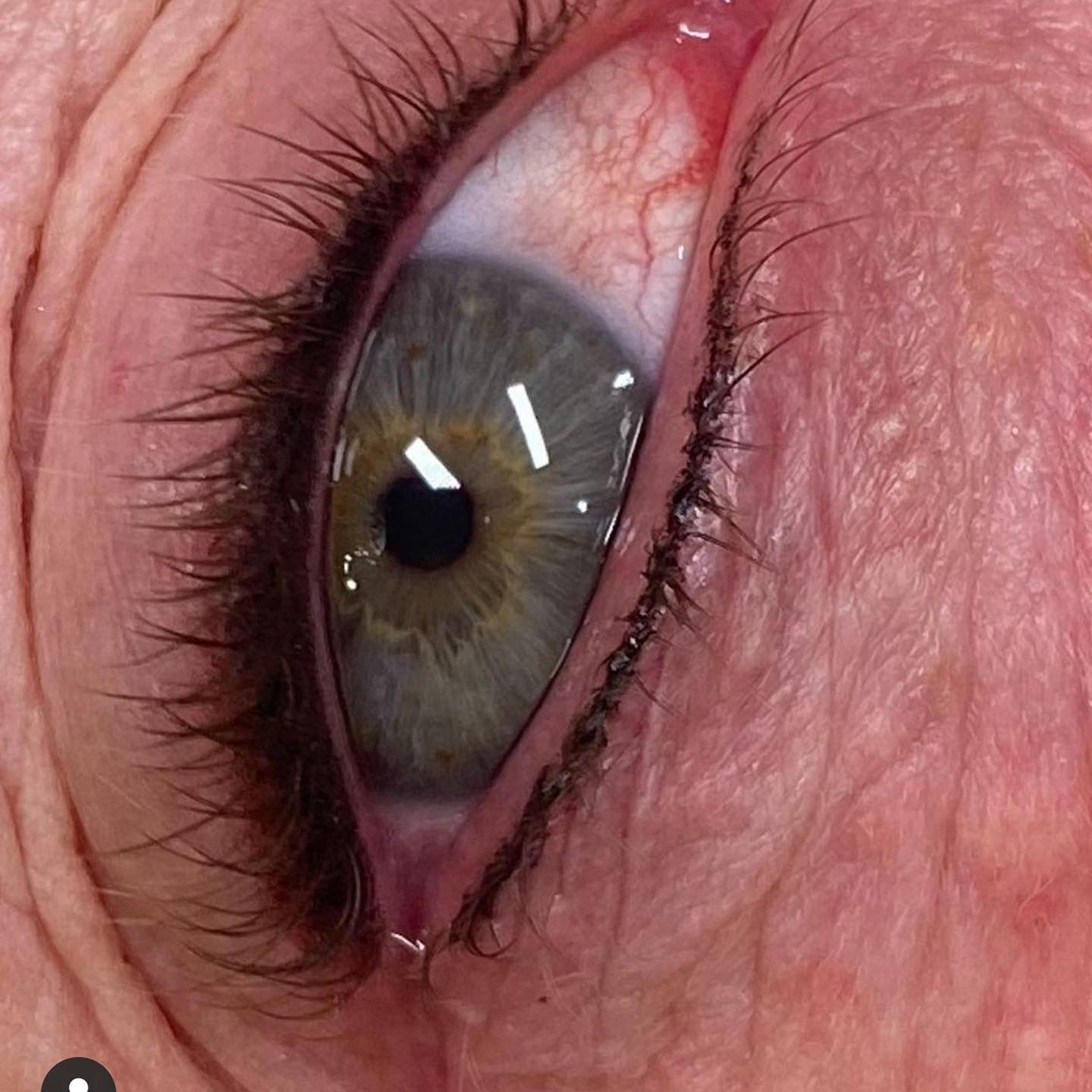 Upper and lower liner