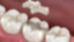 SERVICES_family-dentistry.jpeg