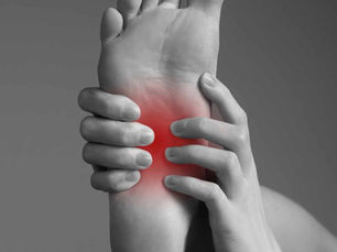 Plantar Fasciitis