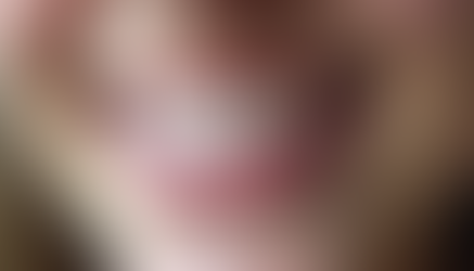 How Clear Aligners Transform Your Smile Step by Step