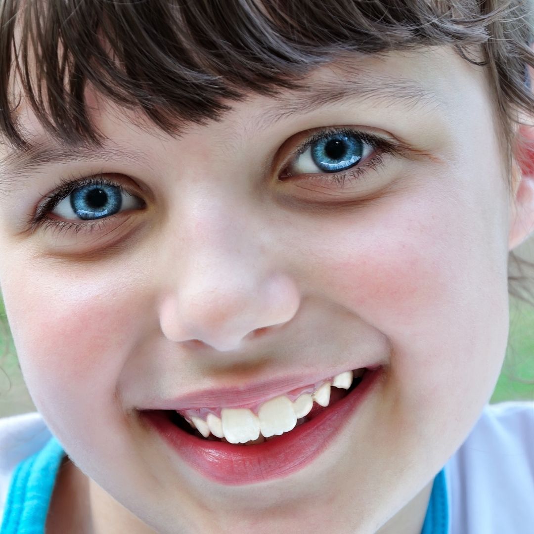 Braces on a child located in Rochester NY