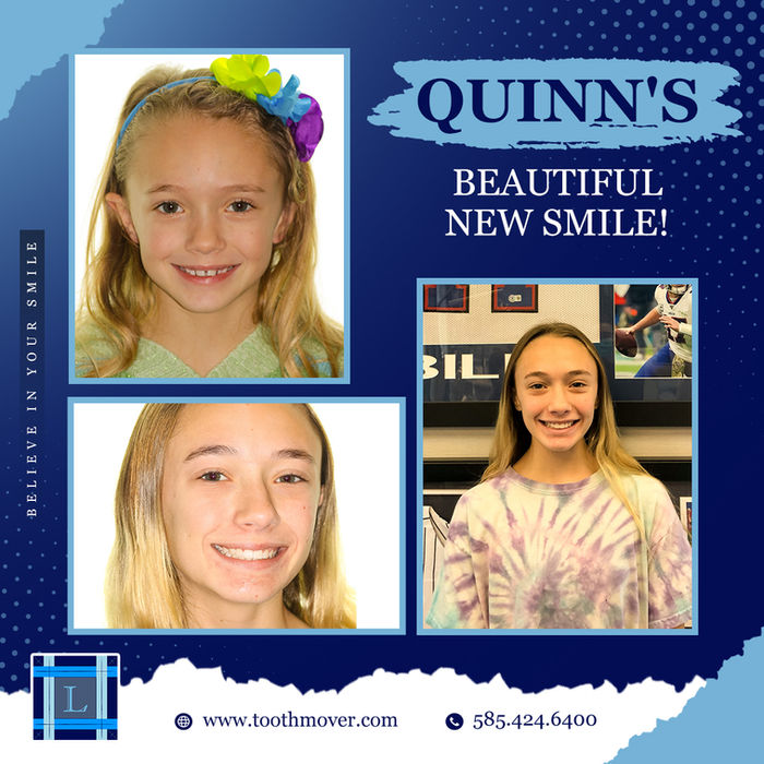Brummble-Digital-Marketing_Quinn-Lazzara_1080x1080_SR-08-nov-2022_v1_R1.jpg