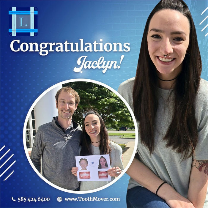 Jaclyn treatment photo