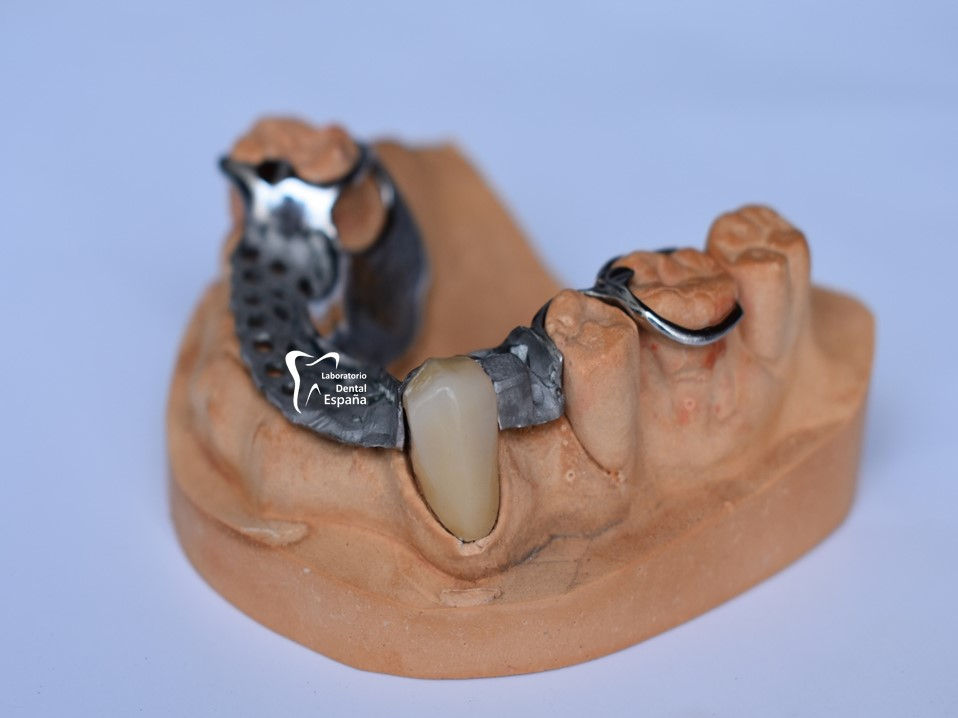 Miniatura: Removible con aditamentos
