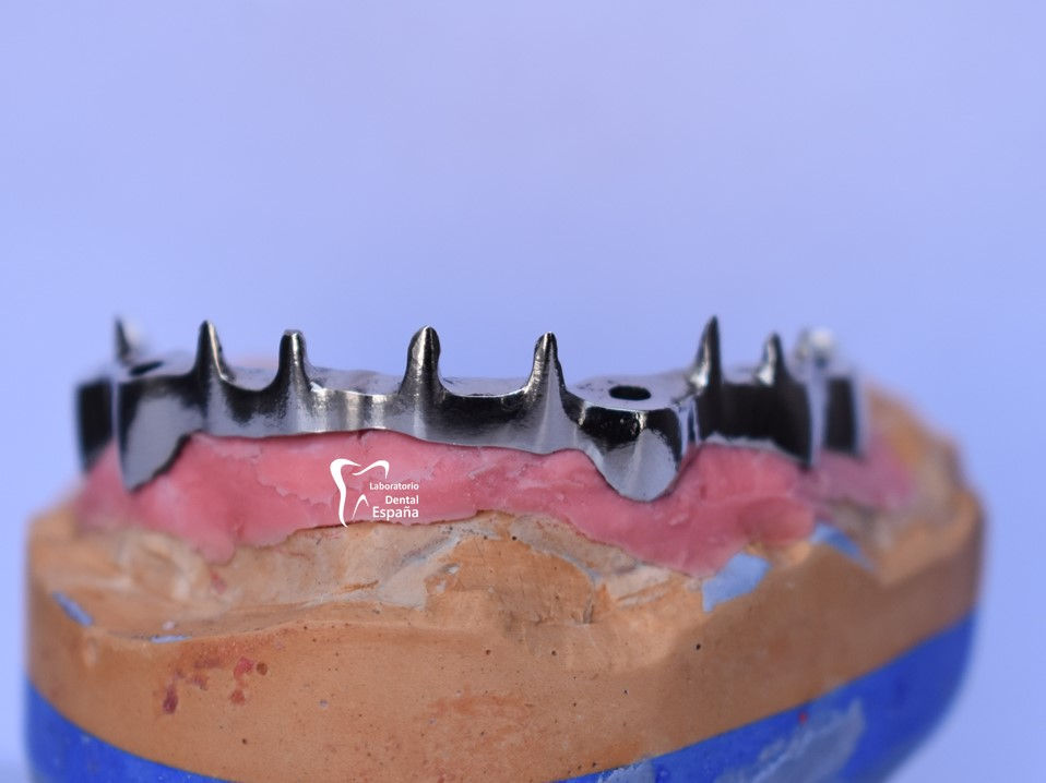 Miniatura: Corona de metal estándar