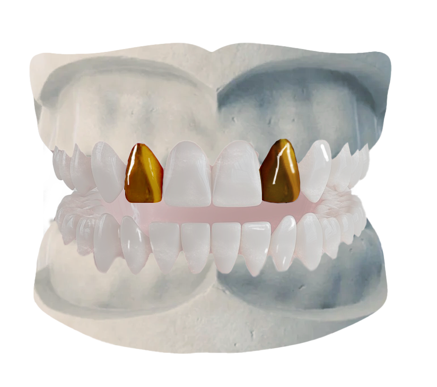 Double cap Grillz