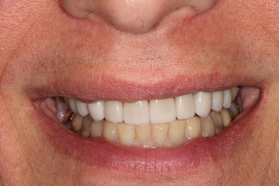 Dave- After Close-up
