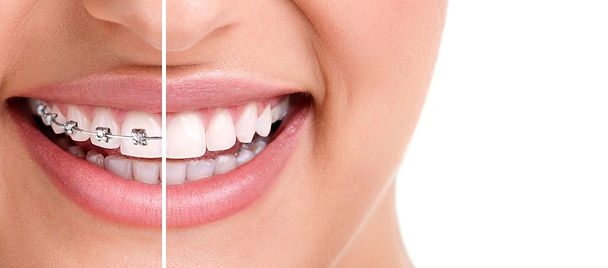 dentist raleigh nc, dentistry raleigh nc, raleigh nc dentist, raleigh dentist, cosmetic dentistry raleigh nc
