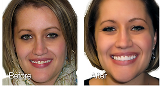 dentist raleigh nc, dentistry raleigh nc, raleigh nc dentist, raleigh dentist, cosmetic dentistry raleigh nc