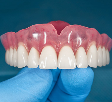 dentureshutter.jpeg