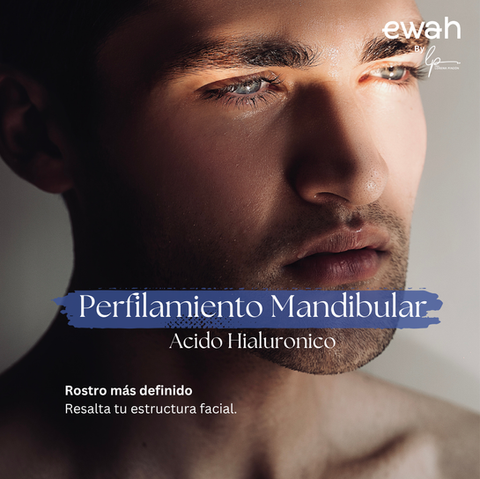 Perfilamiento Mandibular sin cirugia con acido hialuronico, en Bogota