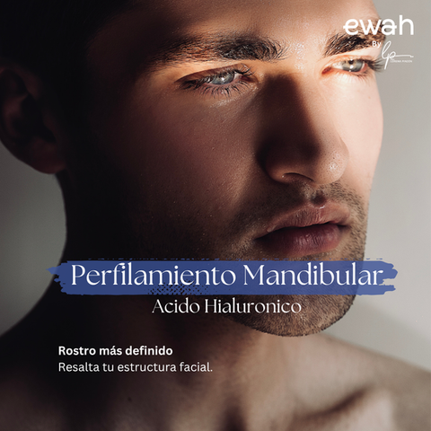 Perfilamiento Mandibular sin cirugia con acido hialuronico, en Bogota