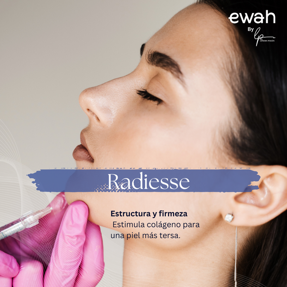 Bioestimulador, Radiesse para mejorar tono facial en Bogota