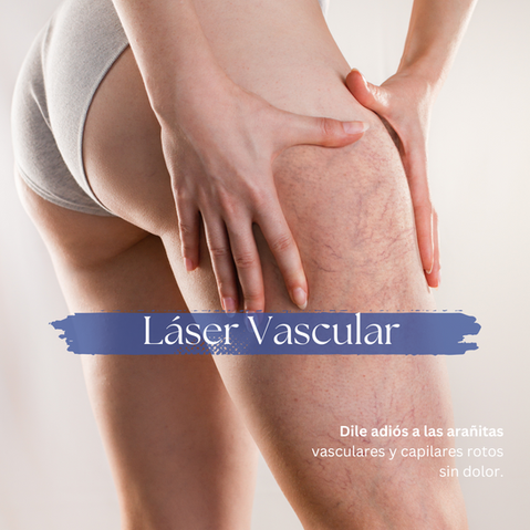 Eliminacion de varices y arañitas vasculares con laser vascular en bogota