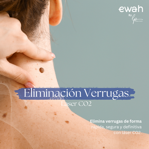 Eliminacion de verrugas con laser de CO2 en bogota