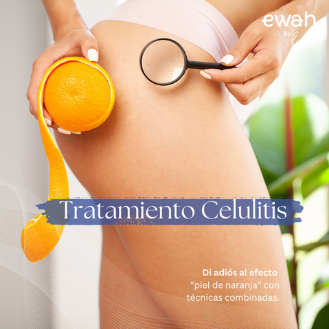 Tratamiento para la celulitis en bogota