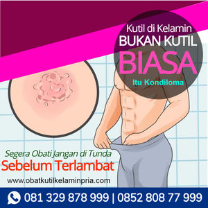 Cara Mengobati Kutil Kelamin Wanita Secara Alami