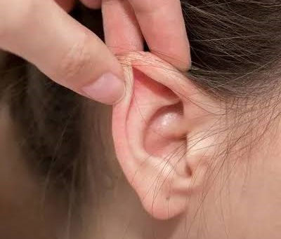 إعادة تشكيل الأذن لتحسين مظهرها التجميلي