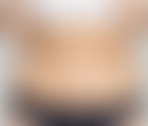 هل يمكن لعملية شفط الدهون أن تقلل من محيط الخصر؟