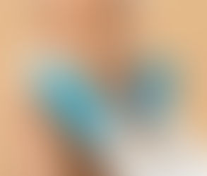 كل ما يجب معرفته قبل الخضوع لعملية شفط الدهون
