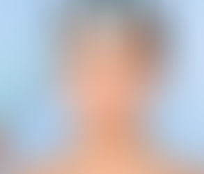 كيف تعمل حقن البوتوكس على تنعيم خطوط الوجه؟
