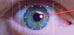 Rayos Laser - San Juan Ophthalmology Group