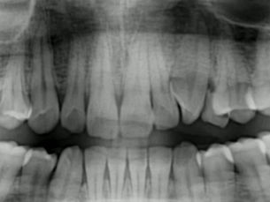A 30-second dental scan that reveals everything🦷 