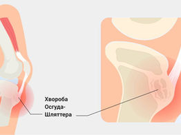 Хвороба Шляттера