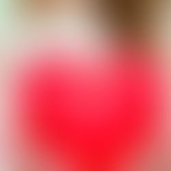 Los problemas cardiovasculares son más frecuentes en las mujeres