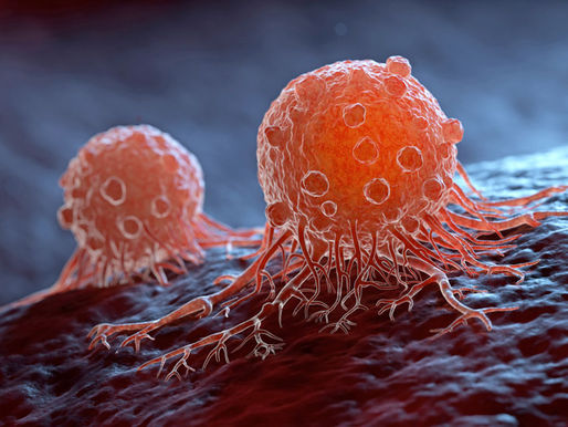 Aseguran que brassiere del futuro detectará cáncer de mama