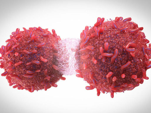 Necesario romper estigmas para detección temprana del cáncer de próstata