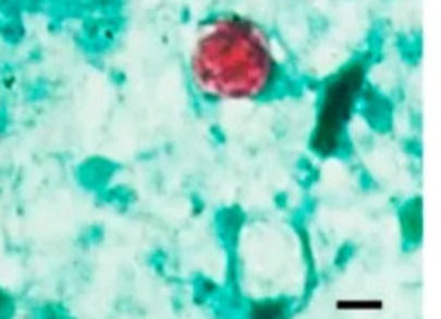 Colabora México con Estados Unidos en investigación de brote de Cyclospora
