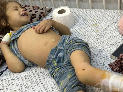 Ola de calor en Gaza, empeora situación de los desplazados