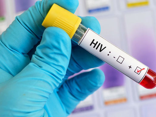 Disminuye 10% mortalidad por VIH en 2018-2023: Censida