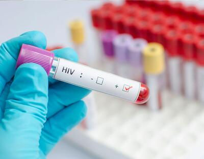 Desigualdad alimenta y hace más letales las pandemias