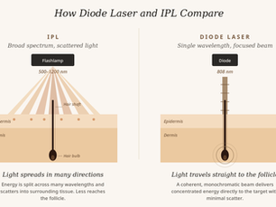 What Is Diode Laser Hair Removal?