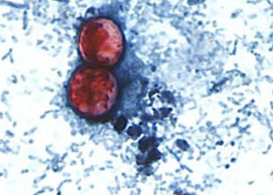 La FDA identifica al posible causante del brote de ciclosporiasis mientras la enfermedad se propaga