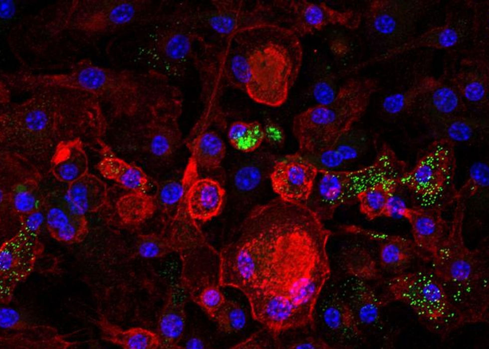 Micrografía fluorescente de células rojas con núcleos azules y puntos verdes sobre fondo negro.
