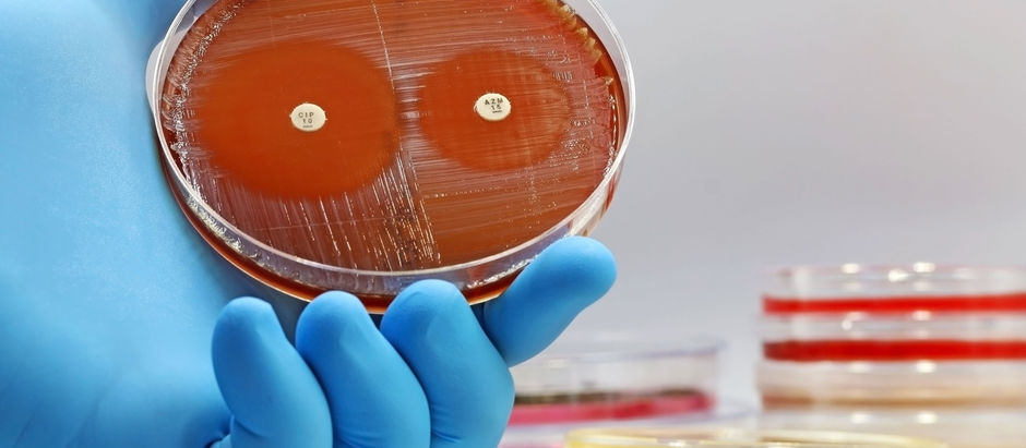 Las proteínas de camello mejoran el tratamiento contra las bacterias resistentes a los medicamentos