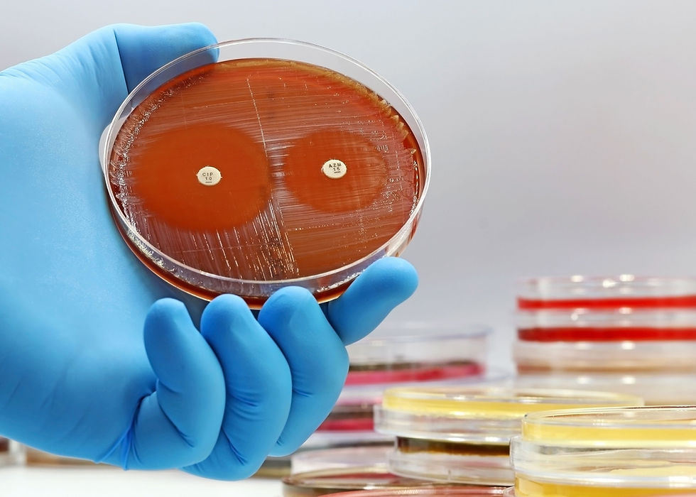 Las proteínas de camello mejoran el tratamiento contra las bacterias resistentes a los medicamentos