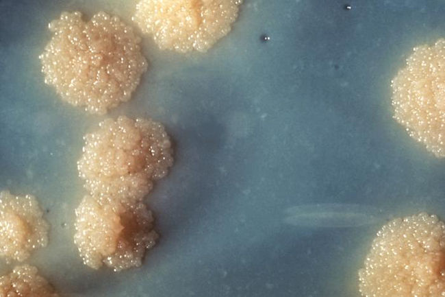 Cultivo de Mycobacterium tuberculosis