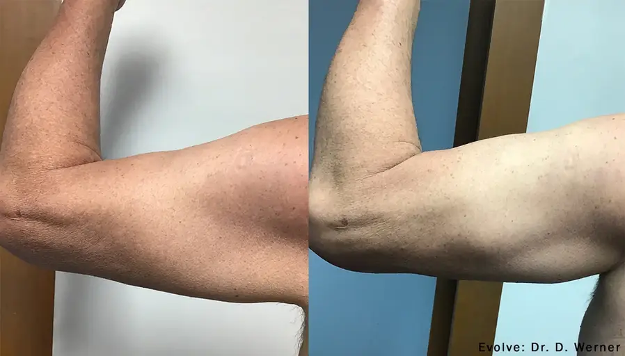 evolve-before-after-dr-d-werner-preview-1.webp