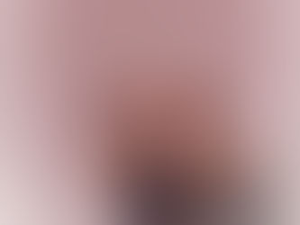 Áföll og erfiðleikar í æsku geta haft áhrif á þróun krónískra heilsufarsvandamála á fullorðinsaldri: 