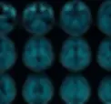 image-ctmri-brain-blue-tone-min.webp