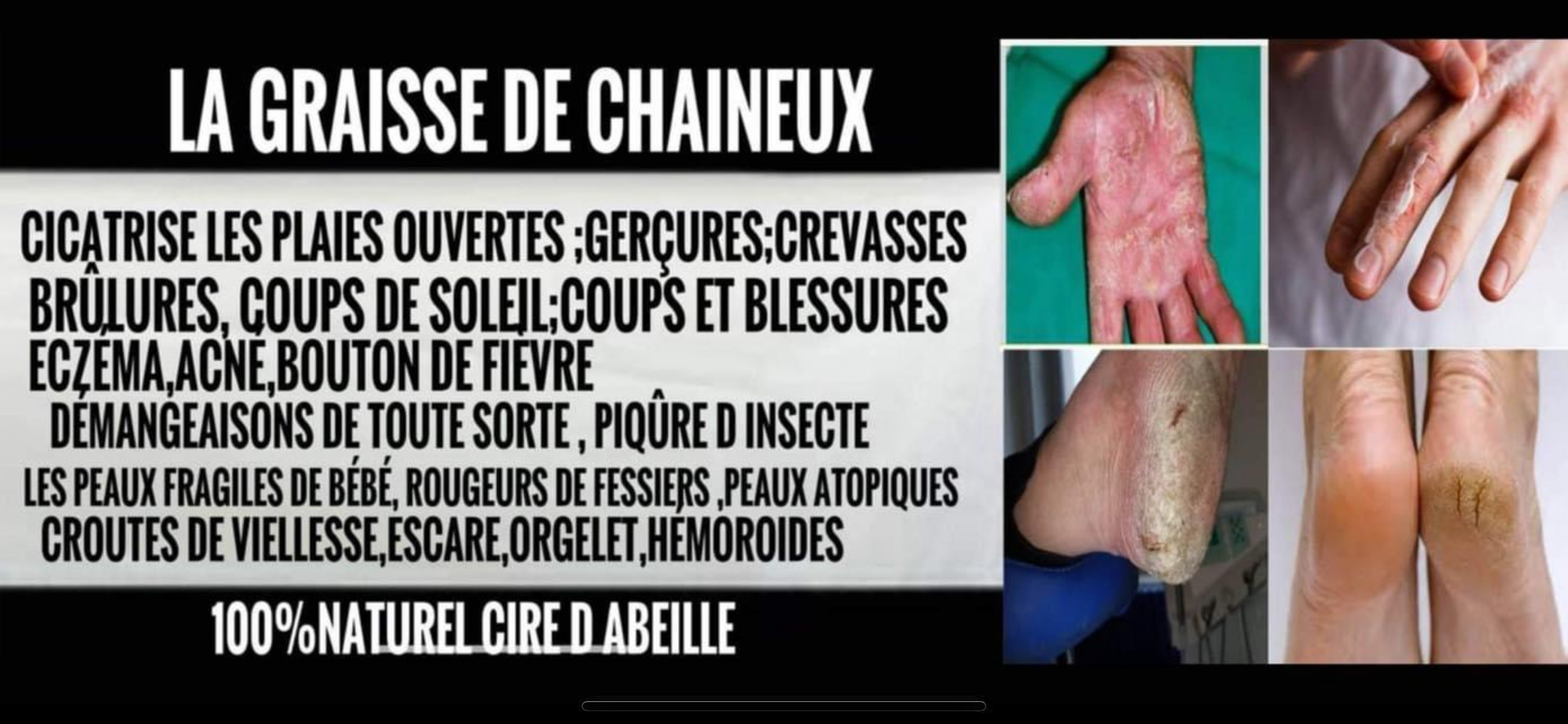 graisse de Chaineux