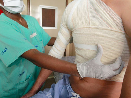 Bahia é referência no tratamento de queimados