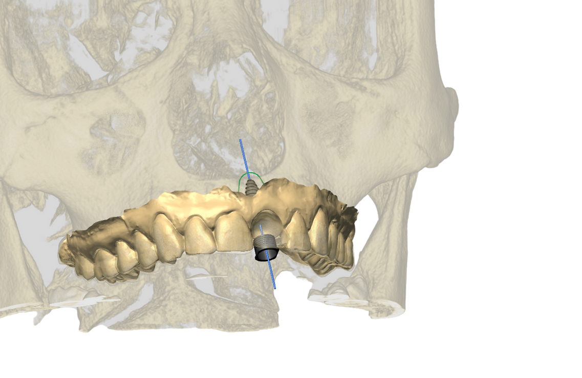 Design sem nome (5).png