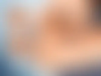 Plasma Pen Upper Eyelid Results: What to Expect